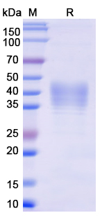 Recombinant Monkeypox virus/MPXV E8L Protein, C-His