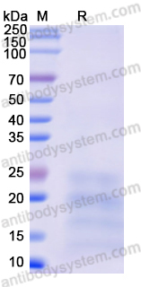 Recombinant Monkeypox virus/MPXV A29L Protein, C-His
