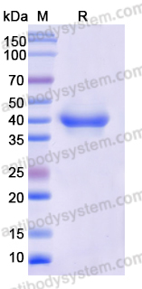 Recombinant Monkeypox virus/MPXV B6R/SL-159 Protein, C-His