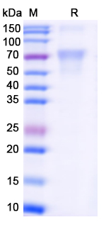 Recombinant Langya virus/LayV G/Glycoprotein, C-His