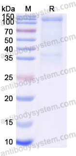Recombinant MARV GP1/Envelope glycoprotein 1 Protein, C-Fc