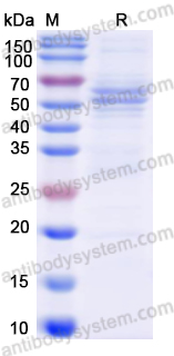 Recombinant Norovirus GII VP1/ORF2 Protein, C-His