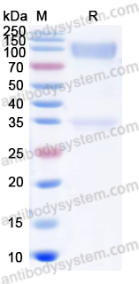 Recombinant ASFV CD2v/pEP402R/CD2H Protein, C-Fc