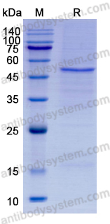 Recombinant SFTSV Mgp1/membrane glycoprotein polyprotein, C-His