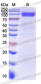 SDS-PAGE for Recombinant Bombali virus/BOMV GP1 Protein, C-His ?>