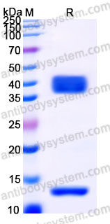 Recombinant Rhesus monkey Latent TGF-beta-1 Protein, N-His