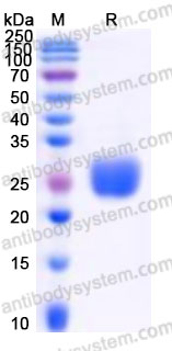 Recombinant Rhesus monkey CD305/LAIR1 Protein, C-His