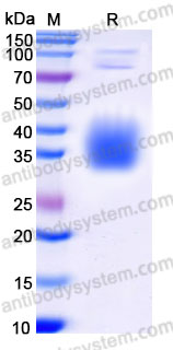 Recombinant Rhesus monkey CD273/PD-L2 Protein, C-His