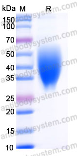 Recombinant Rhesus monkey CD319/SLAMF7 Protein, C-His