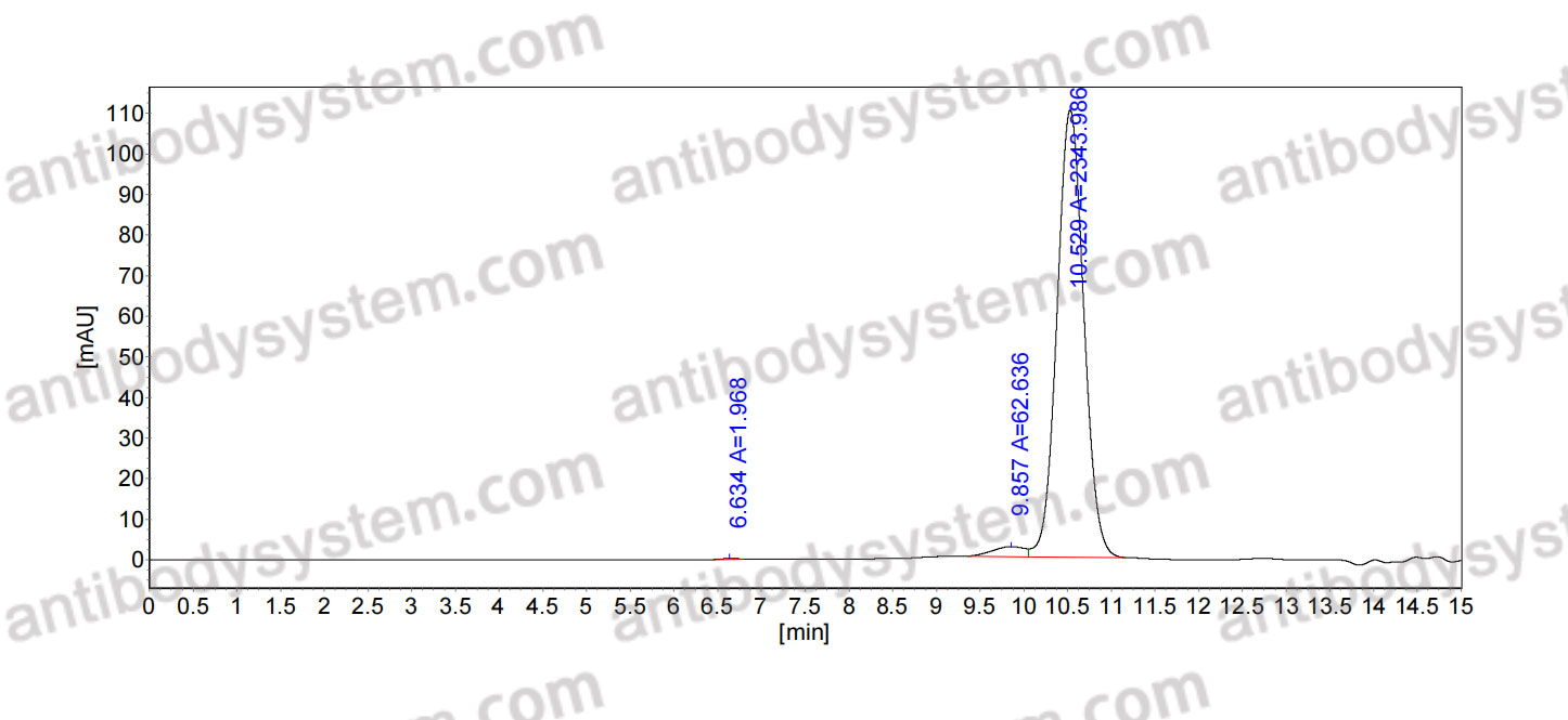 Anti-Human CD35/CR1 Antibody (E11)