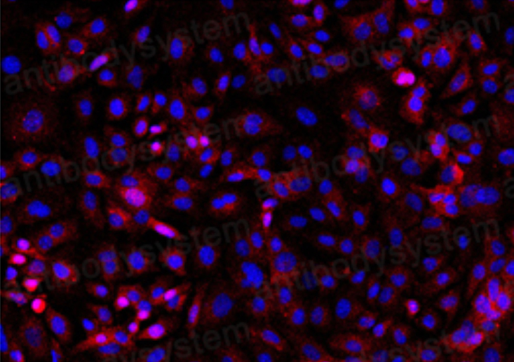 Immunofluorescence for Anti-Human FSHR Antibody (9H11) ?>