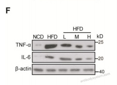 Anti-Human TNFa/TNF-alpha Monoclonal Antibody (1A062)