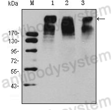 Anti-Human Ki67/MKI67 Monoclonal Antibody (m1A02)