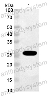Anti-Bovine Bos d 11/CSN2 Polyclonal Antibody
