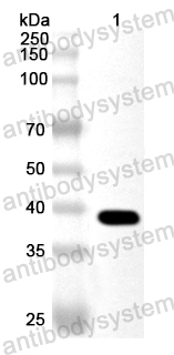 Anti-Human ACOT7 Polyclonal Antibody