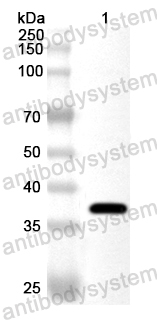 Anti-Human PEX12 Polyclonal Antibody