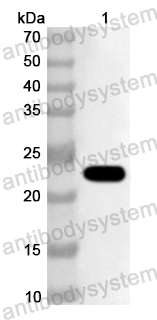 Anti-Human TRIM38 Polyclonal Antibody