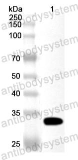 Anti-Human FCHO1 Polyclonal Antibody
