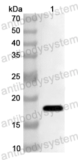 Anti-Human TXNDC9 Polyclonal Antibody