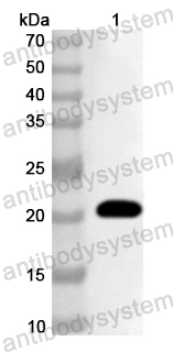 Anti-Human SOCS6 Polyclonal Antibody