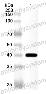 Anti-Human DYNC1I1 Polyclonal Antibody