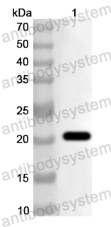 Anti-Human RFXANK Polyclonal Antibody