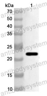 Anti-Human CTDSP2 Polyclonal Antibody