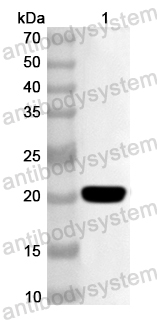 Anti-Human UTY Polyclonal Antibody