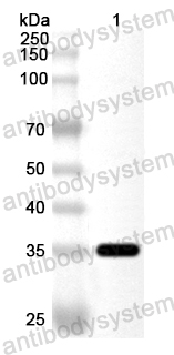 Anti-Human ENC1 Polyclonal Antibody
