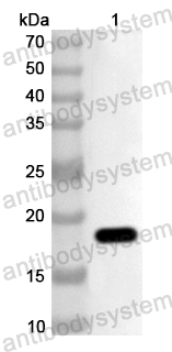Anti-Human ITGB1BP1 Polyclonal Antibody
