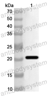 Anti-Human TRDMT1 Polyclonal Antibody