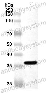 Anti-Human ACOT8 Polyclonal Antibody