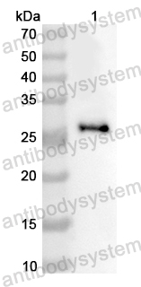 Anti-Human FFAR1 Polyclonal Antibody