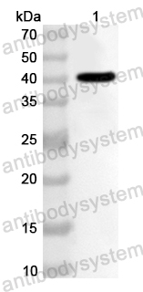 Anti-Human SLC30A4 Polyclonal Antibody