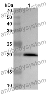 Anti-Human HGS Polyclonal Antibody