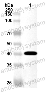 Anti-Human SLC27A2 Polyclonal Antibody