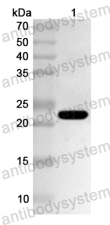 Anti-Human ZNF263 Polyclonal Antibody
