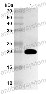 Anti-Human ZBTB5 Polyclonal Antibody