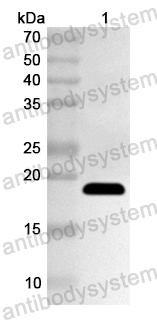 Anti-Human PFAS Polyclonal Antibody