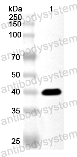 Anti-Human DEGS1 Polyclonal Antibody