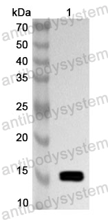 Anti-MDM4 Polyclonal Antibody