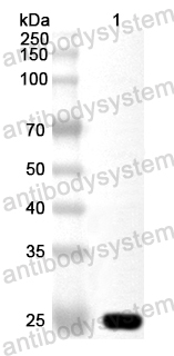 Anti-Human EPHB6 Polyclonal Antibody
