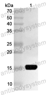 Anti-Human ZBTB22 Polyclonal Antibody