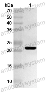 Anti-Human PPM1G Polyclonal Antibody