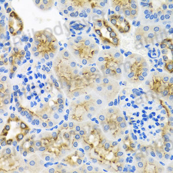Immunohistochemical for Anti-Human STX7 Polyclonal Antibody ?>