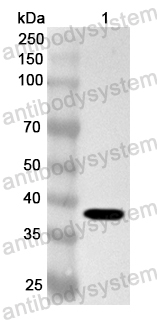 Anti-Human GSC2 Polyclonal Antibody
