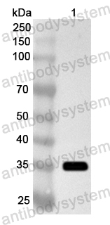 Anti-Human PRPF4 Polyclonal Antibody