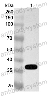 Anti-Human RBFOX2 Polyclonal Antibody