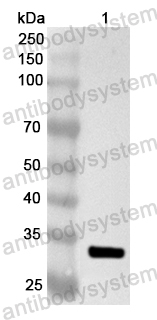 Anti-Human B4GALT5 Polyclonal Antibody