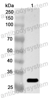 Anti-Human SART1 Polyclonal Antibody